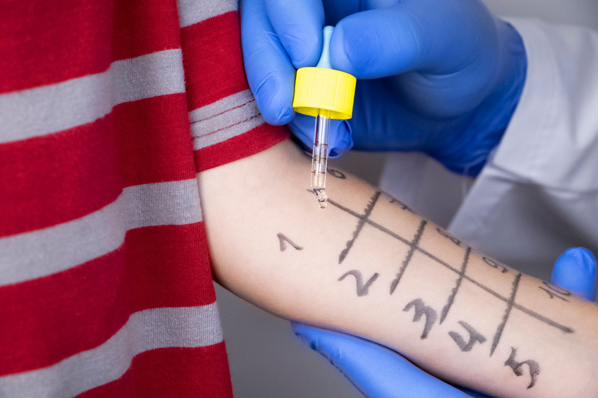 Diagnostica Allergologica Avanzata e Pneumologia Pediatrica